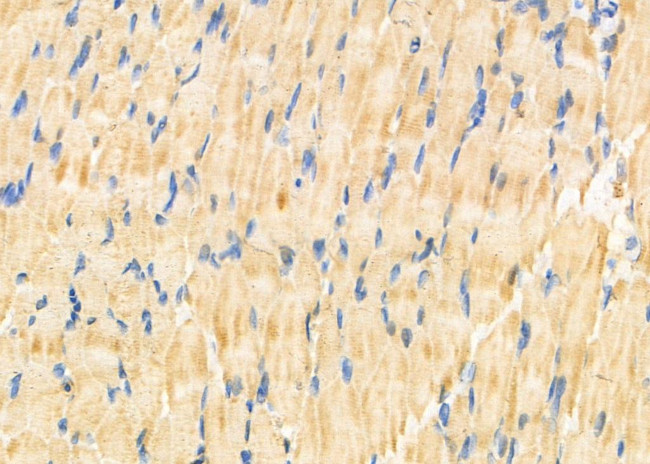 ACTBL2 Antibody in Immunohistochemistry (Paraffin) (IHC (P))