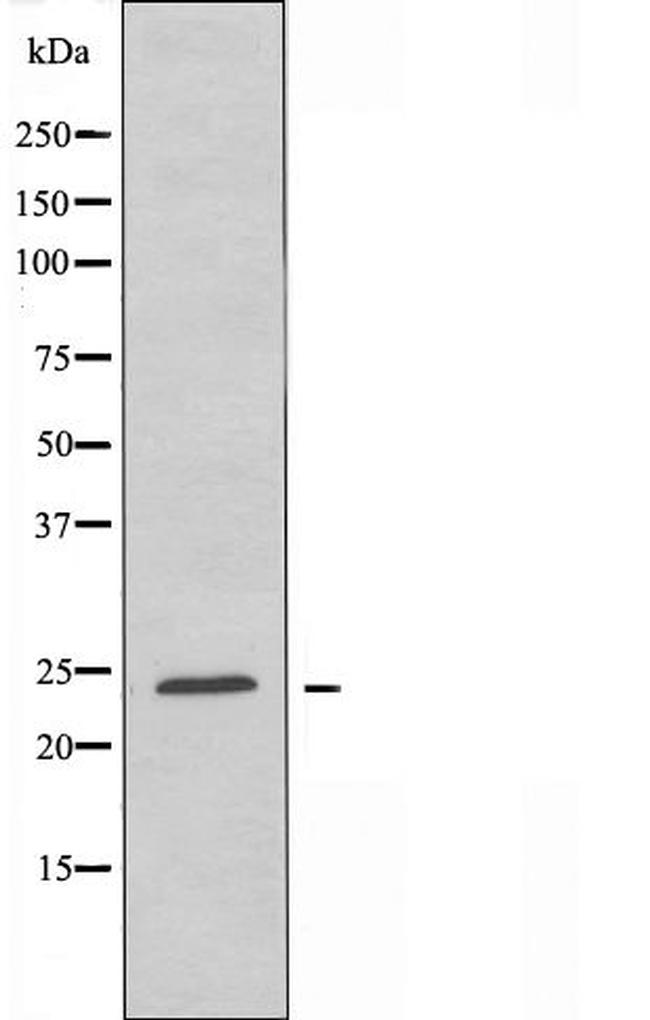 CD79a Antibody in Western Blot (WB)