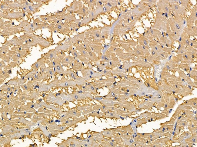 NKG2D Antibody in Immunohistochemistry (Paraffin) (IHC (P))