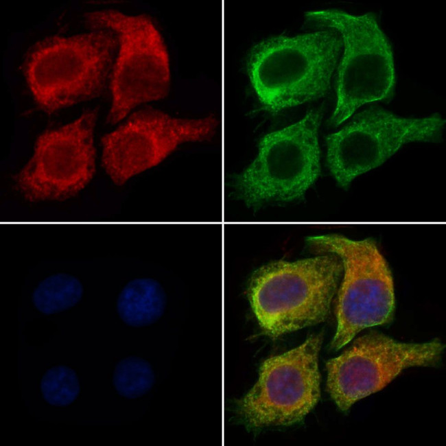 MCPH1 Antibody in Immunocytochemistry (ICC/IF)