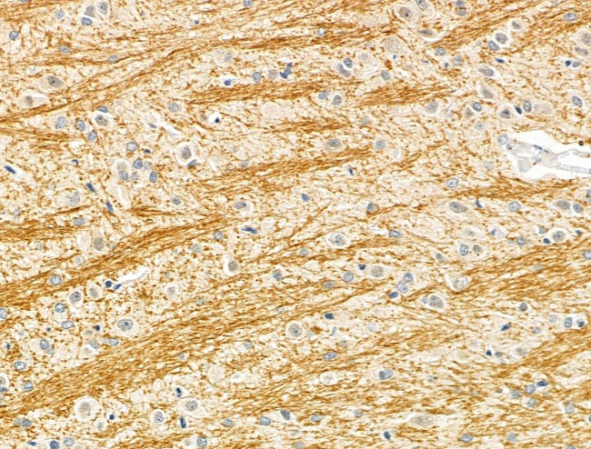 MCPH1 Antibody in Immunohistochemistry (Paraffin) (IHC (P))