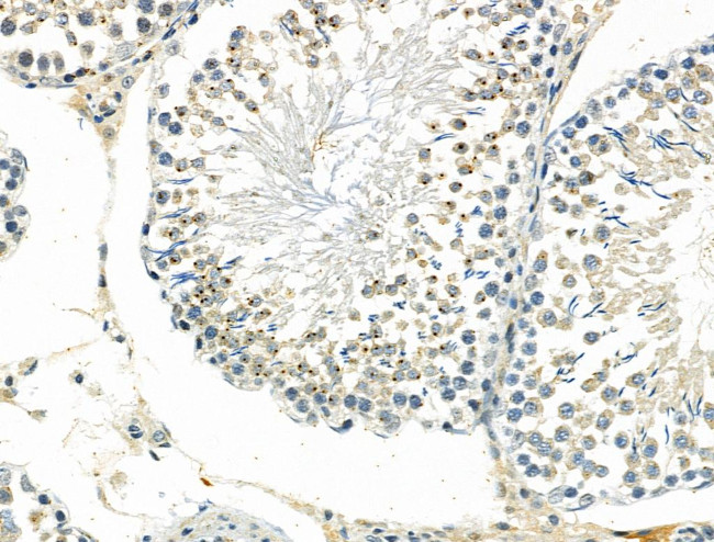 MCPH1 Antibody in Immunohistochemistry (Paraffin) (IHC (P))