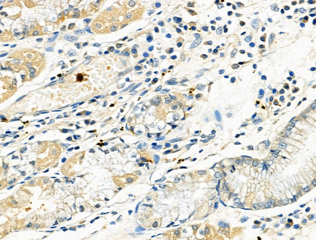 RUNX3 Antibody in Immunohistochemistry (Paraffin) (IHC (P))