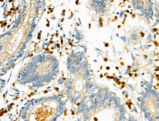 RUNX3 Antibody in Immunohistochemistry (Paraffin) (IHC (P))