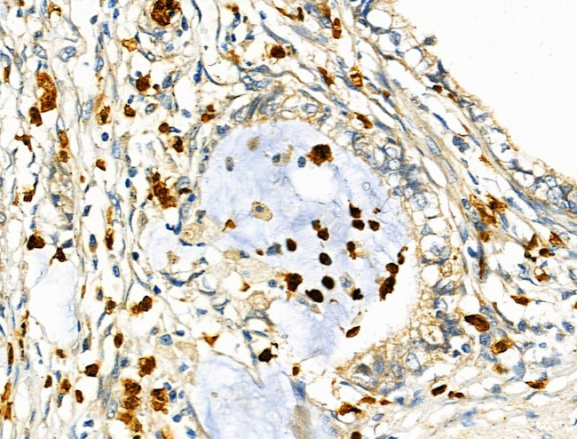 RUNX3 Antibody in Immunohistochemistry (Paraffin) (IHC (P))