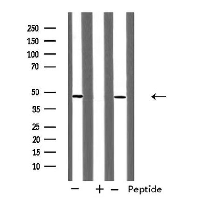 RUNX3 Antibody in Western Blot (WB)