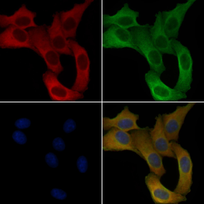 LBP Antibody in Immunocytochemistry (ICC/IF)