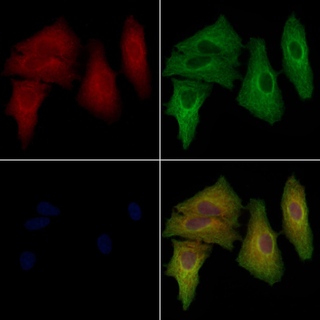 LBP Antibody in Immunocytochemistry (ICC/IF)