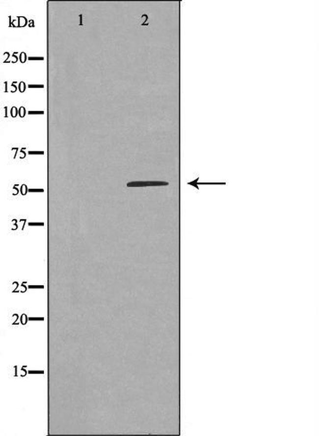 LBP Antibody in Western Blot (WB)