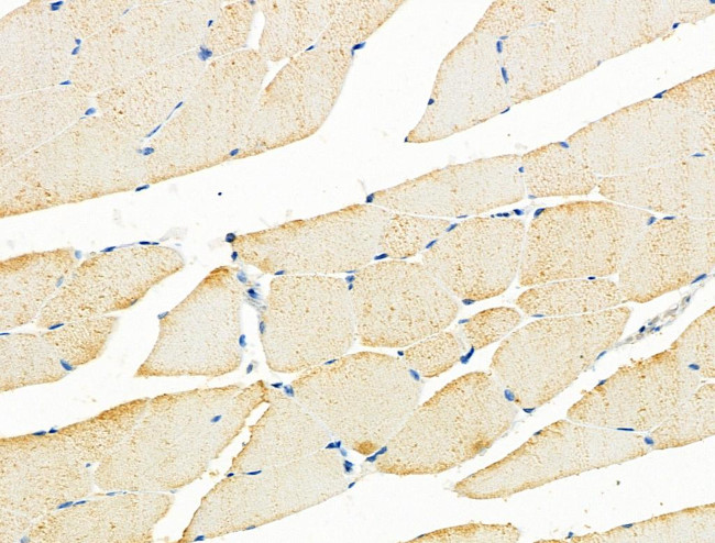 ADORA3 Antibody in Immunohistochemistry (Paraffin) (IHC (P))