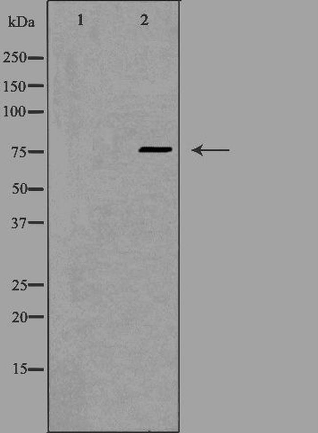 FZD3 Antibody in Western Blot (WB)