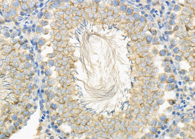 HRH1 Antibody in Immunohistochemistry (Paraffin) (IHC (P))