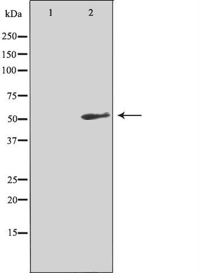 TACR3 Antibody in Western Blot (WB)