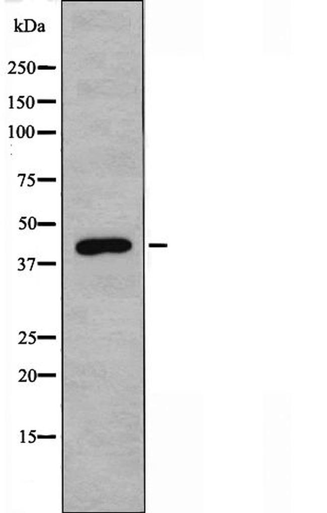 NMBR Antibody in Western Blot (WB)