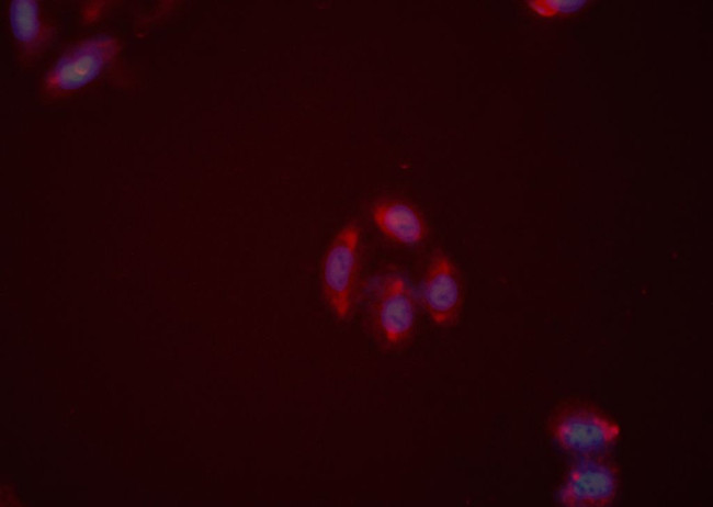 NPY2R Antibody in Immunocytochemistry (ICC/IF)