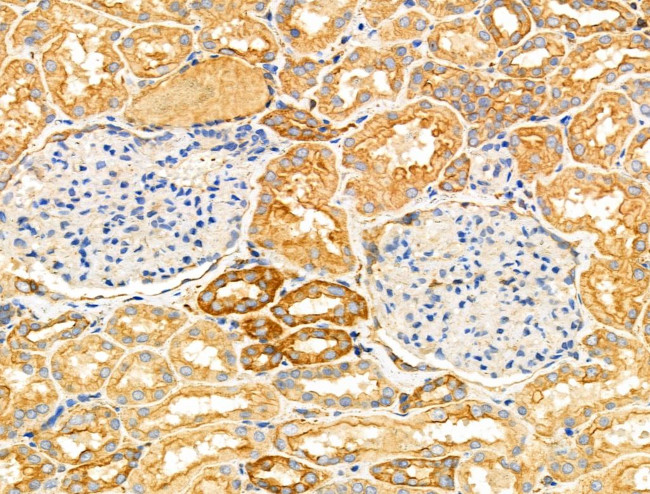 NPY2R Antibody in Immunohistochemistry (Paraffin) (IHC (P))