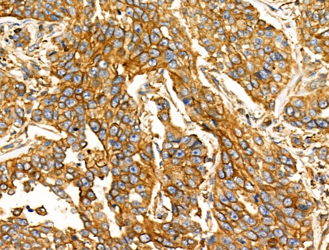 NPY2R Antibody in Immunohistochemistry (Paraffin) (IHC (P))