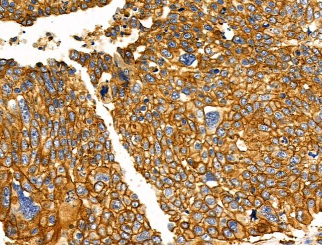 NPY2R Antibody in Immunohistochemistry (Paraffin) (IHC (P))