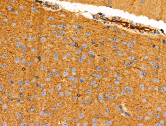 NPY2R Antibody in Immunohistochemistry (Paraffin) (IHC (P))