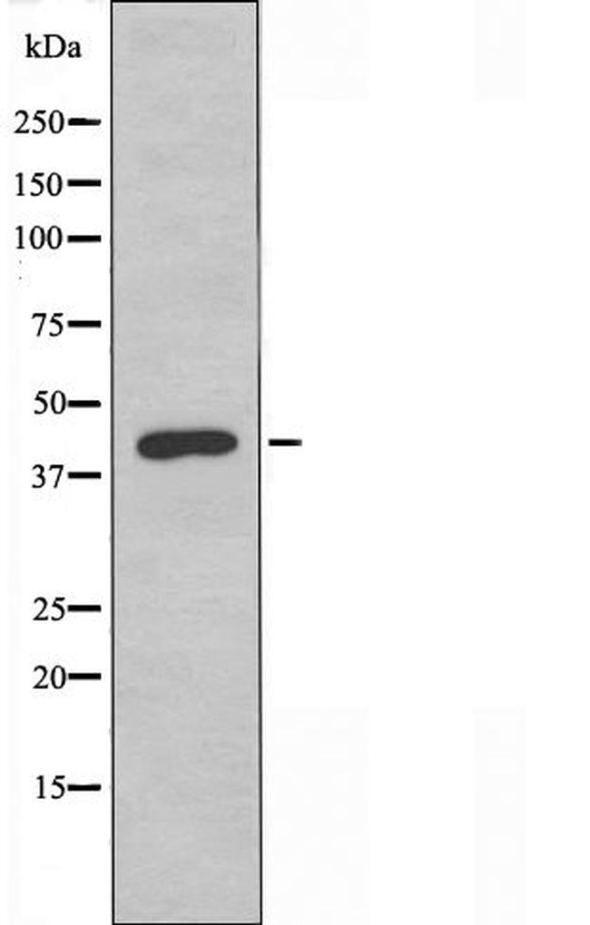 OR2AJ1 Antibody in Western Blot (WB)