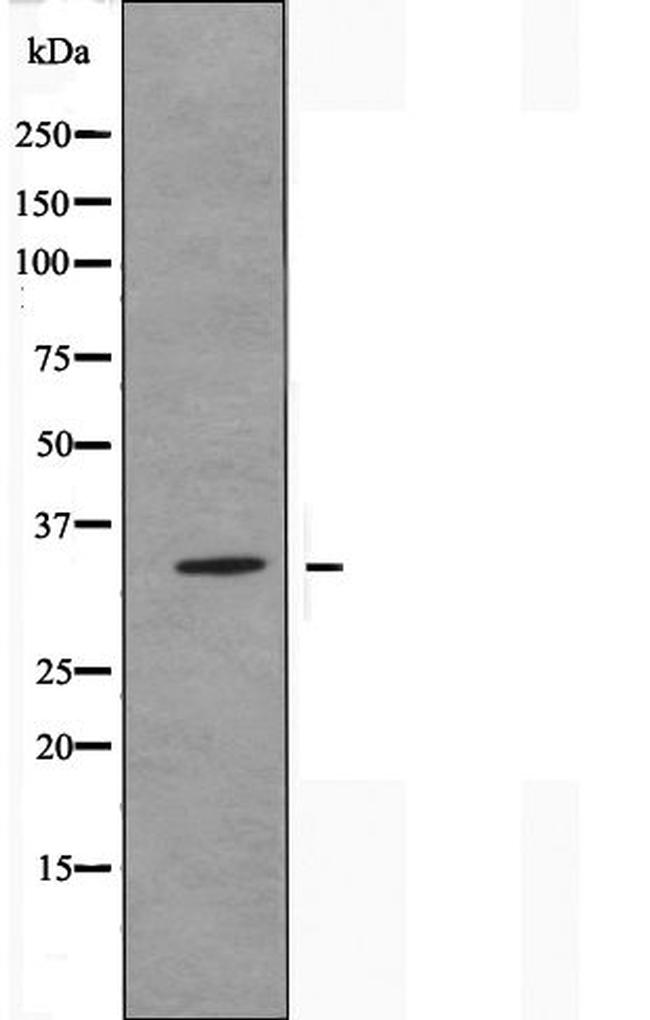 OR2T11 Antibody in Western Blot (WB)