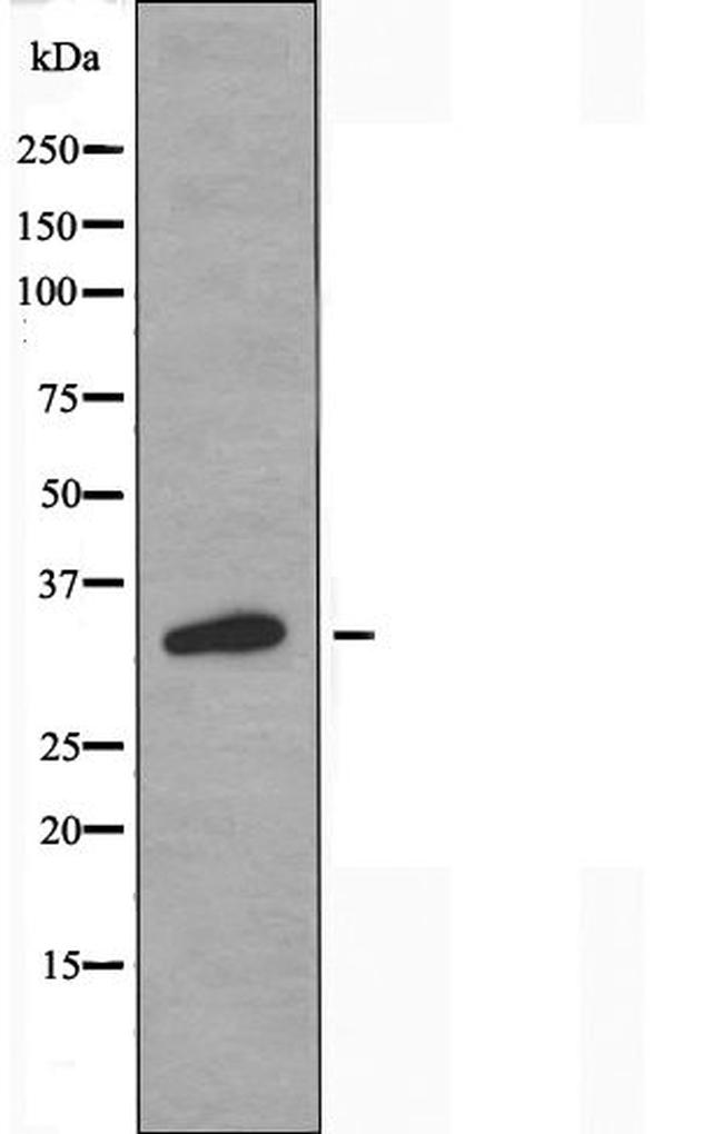 OR2T2/OR2T35 Antibody in Western Blot (WB)