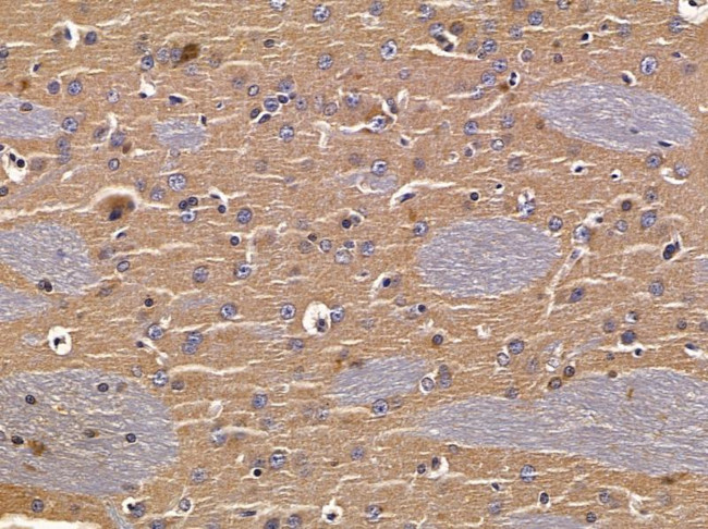 OR5H15 Antibody in Immunohistochemistry (Paraffin) (IHC (P))