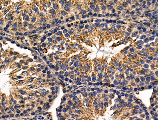 Rhodopsin Antibody in Immunohistochemistry (Paraffin) (IHC (P))