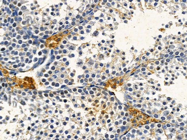 OR2B8P Antibody in Immunohistochemistry (Paraffin) (IHC (P))