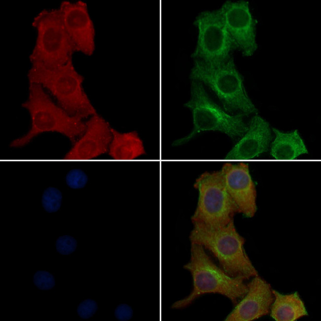 OR2K2 Antibody in Immunocytochemistry (ICC/IF)