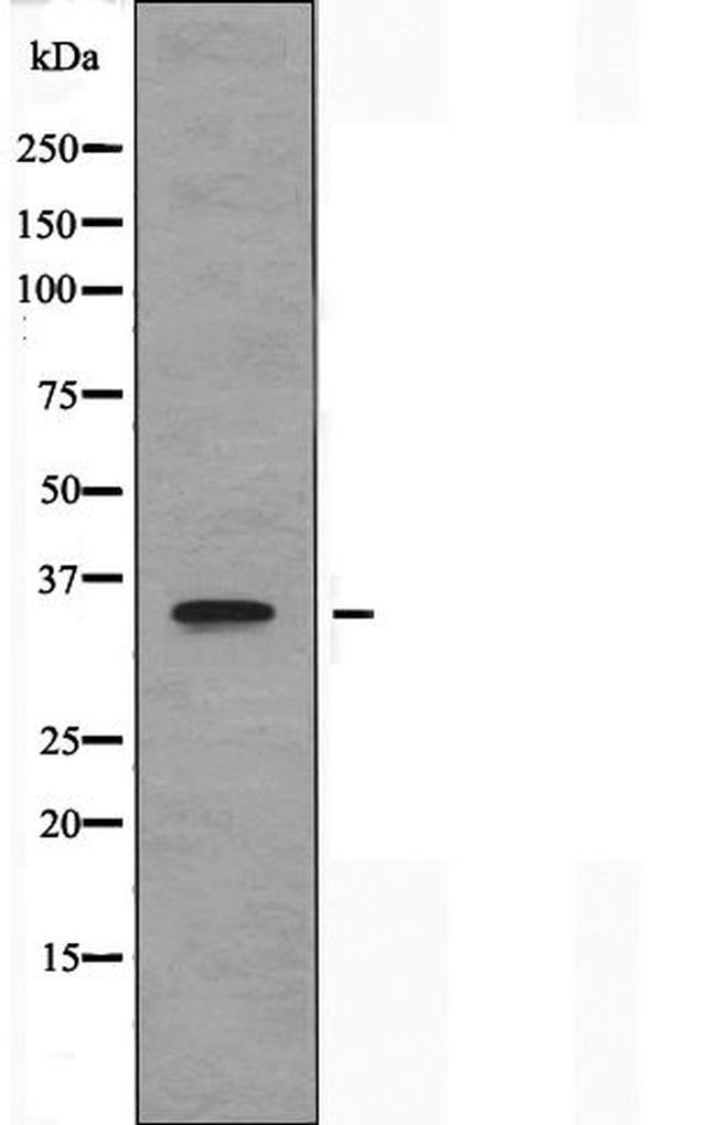 OR8J3 Antibody in Western Blot (WB)