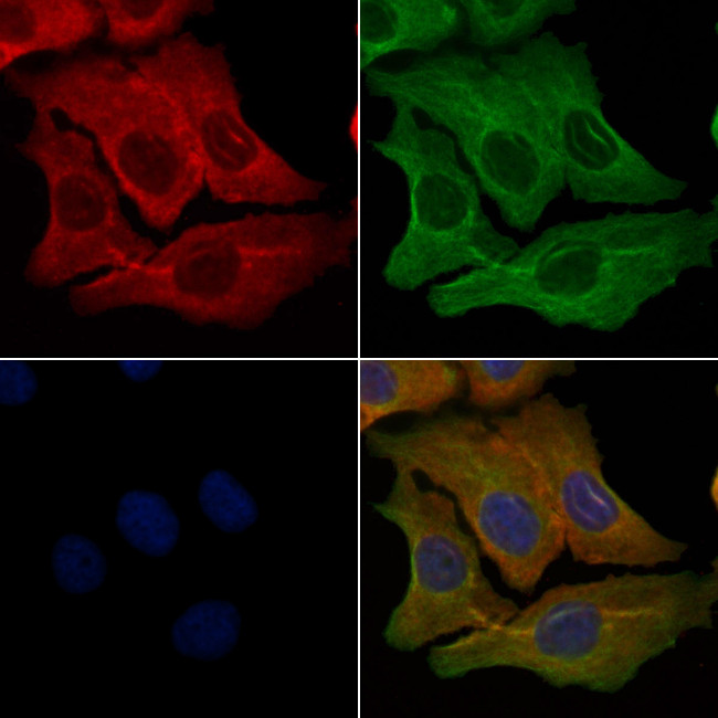 OR9Q2 Antibody in Immunocytochemistry (ICC/IF)