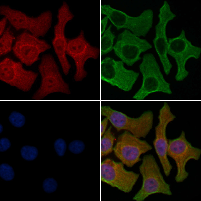 P2Y8 Antibody in Immunocytochemistry (ICC/IF)