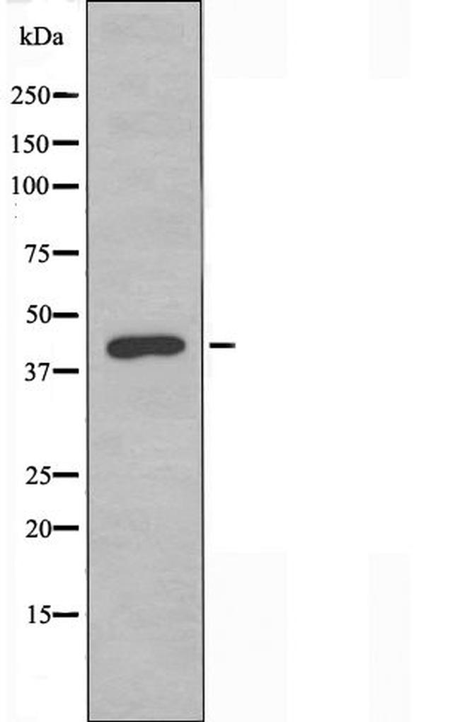 P2Y8 Antibody in Western Blot (WB)