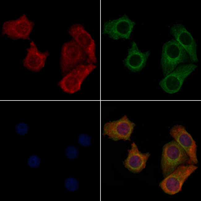 SLC52A2 Antibody in Immunocytochemistry (ICC/IF)