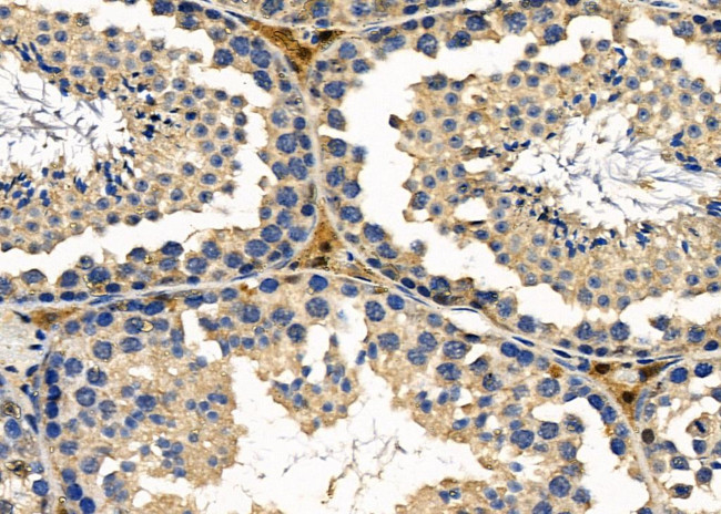 GPR10 Antibody in Immunohistochemistry (Paraffin) (IHC (P))