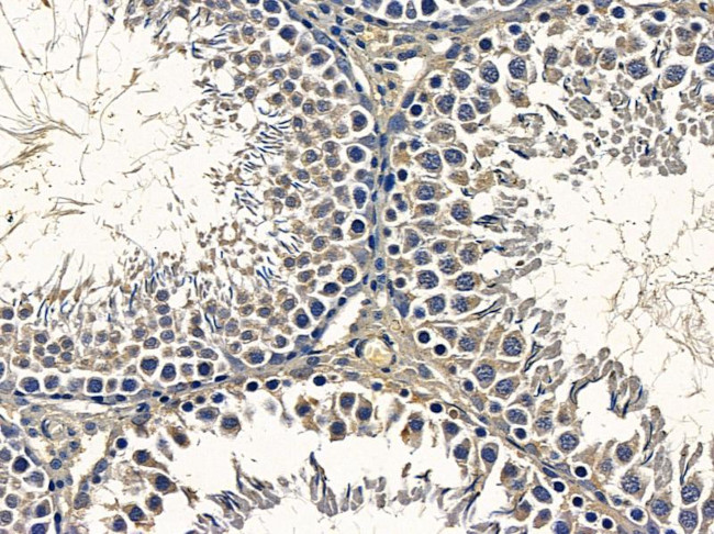 TAS2R8 Antibody in Immunohistochemistry (Paraffin) (IHC (P))