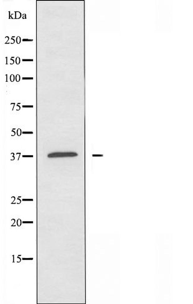 OR10Z1 Antibody in Western Blot (WB)