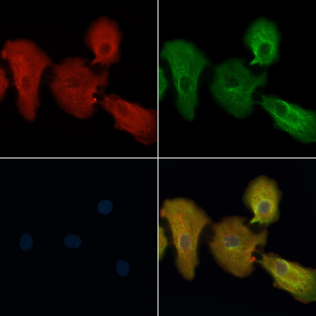 OR11H1/OR11H2/OR11H12 Antibody in Immunocytochemistry (ICC/IF)