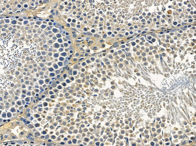 OR5A1 Antibody in Immunohistochemistry (Paraffin) (IHC (P))