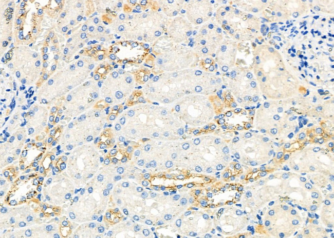 Perforin Antibody in Immunohistochemistry (Paraffin) (IHC (P))