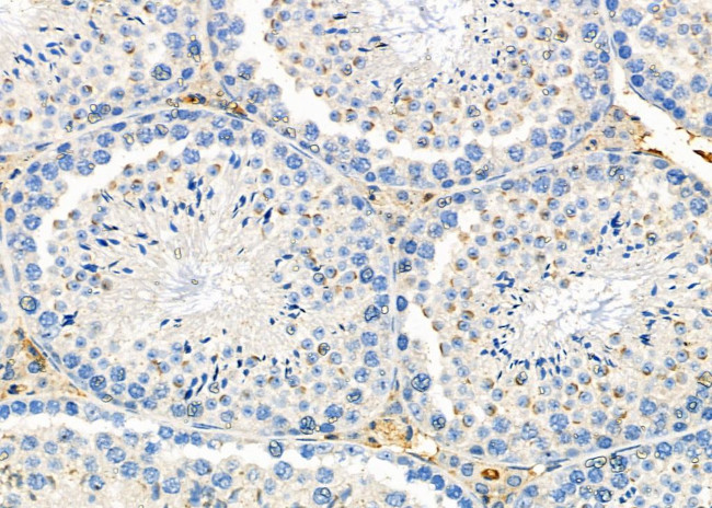 Perforin Antibody in Immunohistochemistry (Paraffin) (IHC (P))