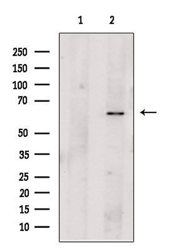 Perforin Antibody in Western Blot (WB)