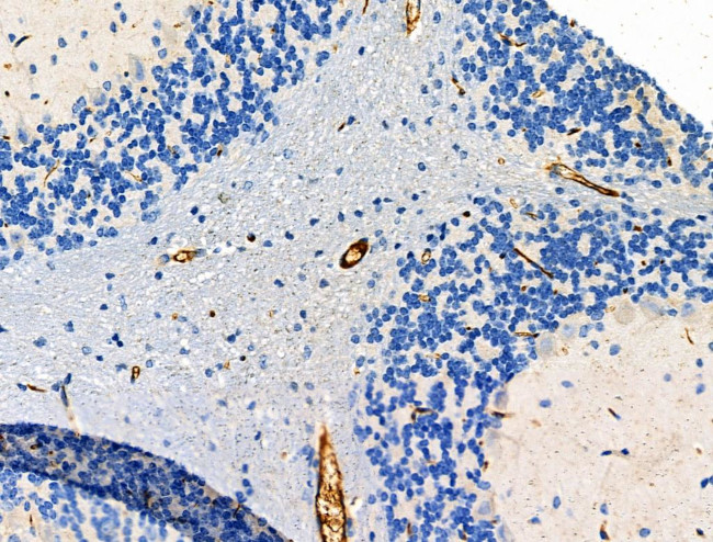 BVES Antibody in Immunohistochemistry (Paraffin) (IHC (P))