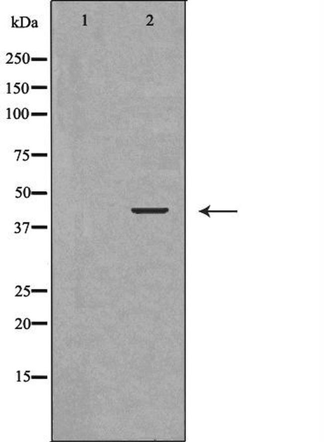 BVES Antibody in Western Blot (WB)