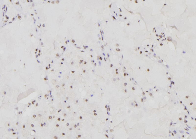 CHOP Antibody in Immunohistochemistry (Paraffin) (IHC (P))