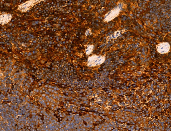 CHOP Antibody in Immunohistochemistry (Paraffin) (IHC (P))