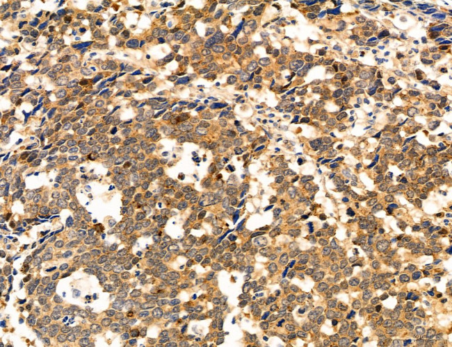 CHOP Antibody in Immunohistochemistry (Paraffin) (IHC (P))