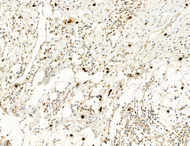 CHOP Antibody in Immunohistochemistry (Paraffin) (IHC (P))