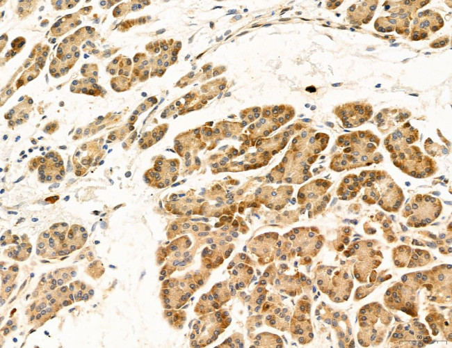 CHOP Antibody in Immunohistochemistry (Paraffin) (IHC (P))